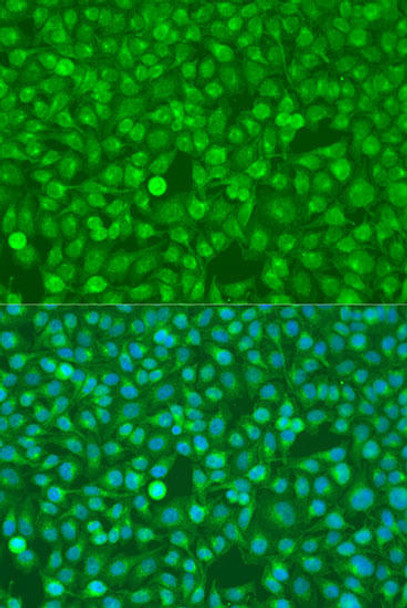 Anti-CSF3 Antibody (CAB15660)