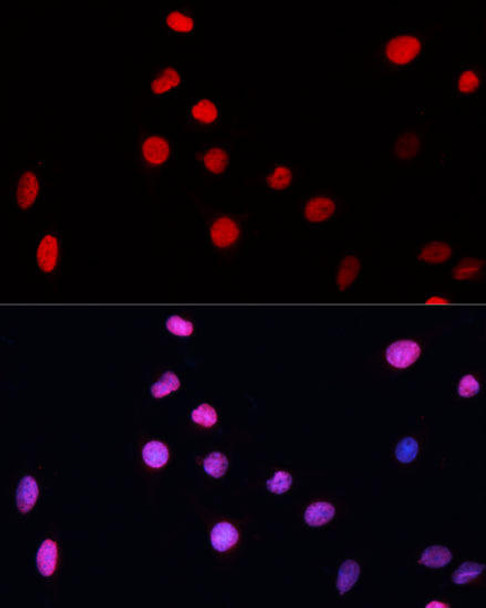 Anti-ERCC5 Antibody (CAB1605)