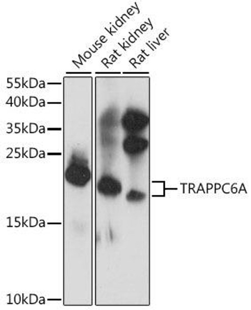 Anti-TRAPPC6A Antibody (CAB16143)