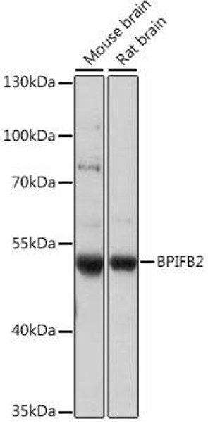 Anti-BPIFB2 Antibody (CAB16148)