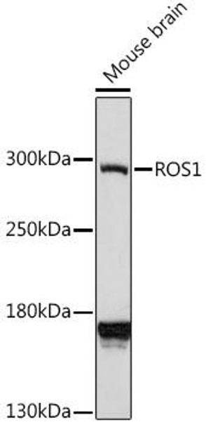 Anti-ROS1 Antibody (CAB16669)