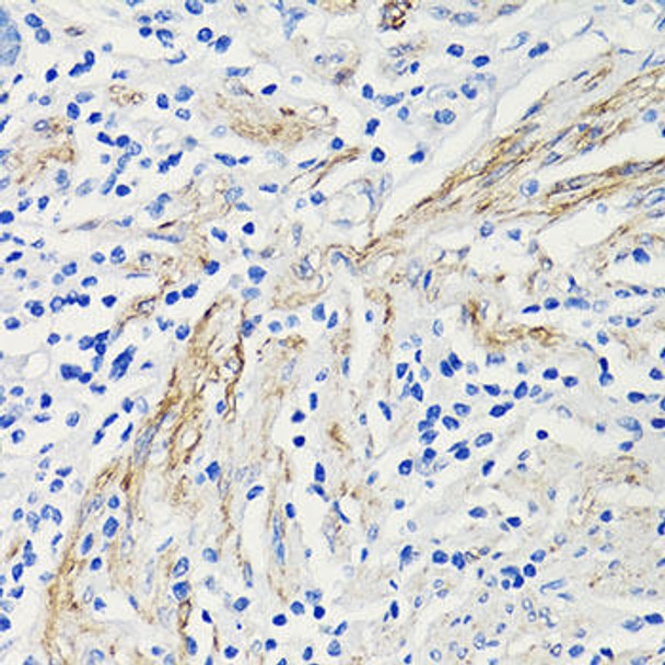 Anti-CCL4 Antibody (CAB1671)