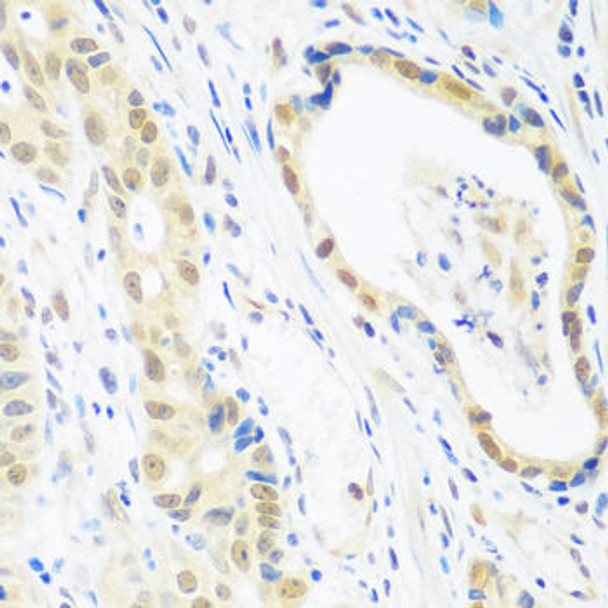 Anti-POLR2E Antibody (CAB1755)