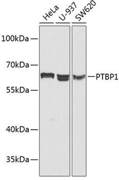 Anti-PTBP1 Antibody (CAB1831)