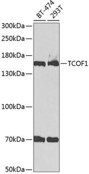 Anti-TCOF1 Antibody (CAB2512)