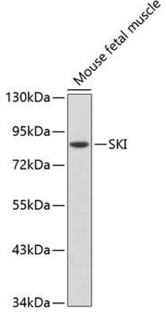 Anti-SKI Antibody (CAB2879)