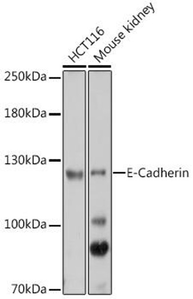 Anti-E-Cadherin Antibody (CAB3044)