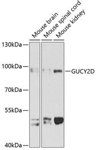 Anti-GUCY2D Antibody (CAB3605)