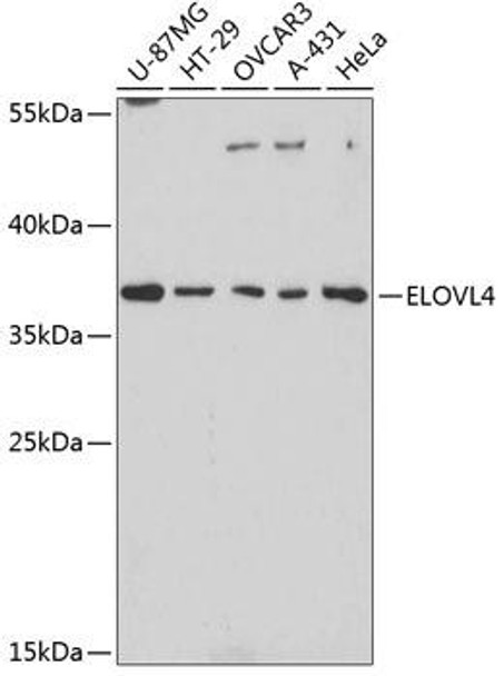 Anti-ELOVL4 Antibody (CAB3639)