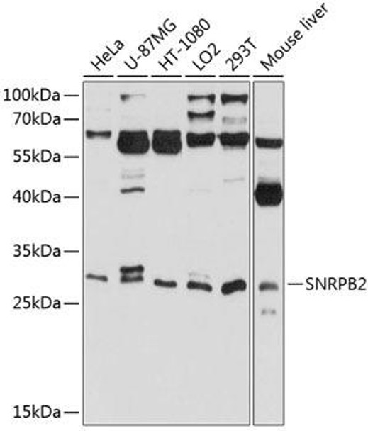 Anti-SNRPB2 Antibody (CAB8908)