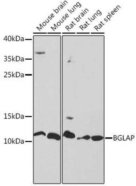Anti-BGLAP Antibody (CAB18241)