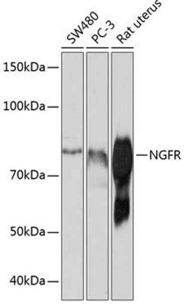 Anti-NGFR Antibody (CAB19088)