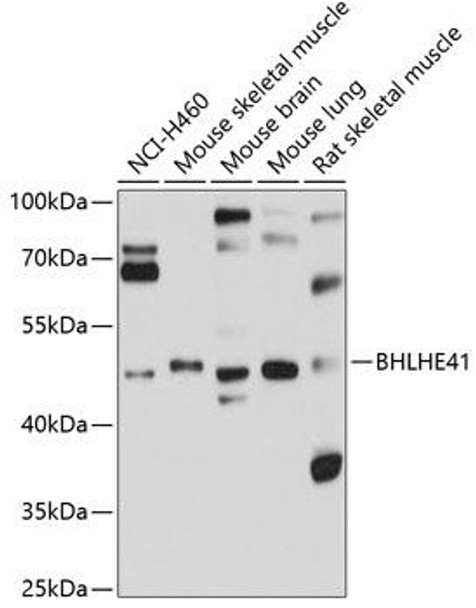 Anti-BHLHE41 Antibody (CAB10555)