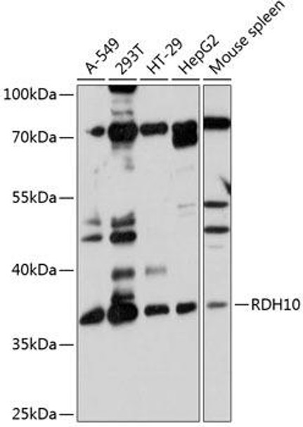 Anti-RDH10 Antibody (CAB12136)