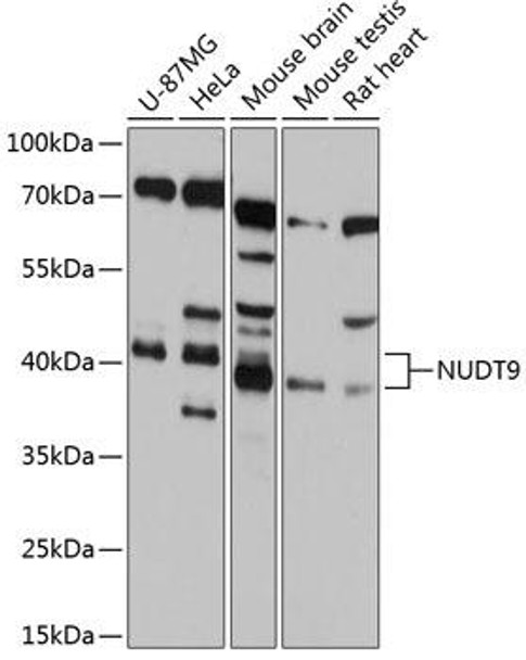 Anti-NUDT9 Antibody (CAB12220)