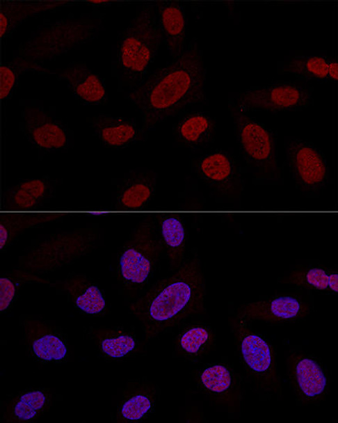 Anti-Snail Antibody (CAB12301)