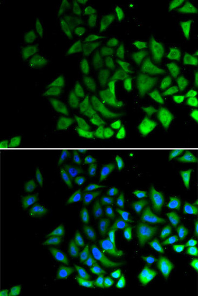 Anti-PIWIL-1 Antibody (CAB12349)