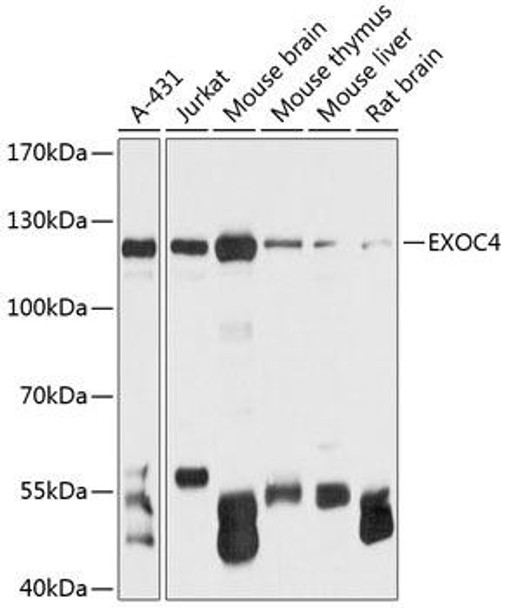 Anti-EXOC4 Antibody (CAB12374)