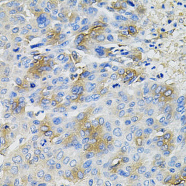 Anti-SERPINA1 Antibody (CAB12481)