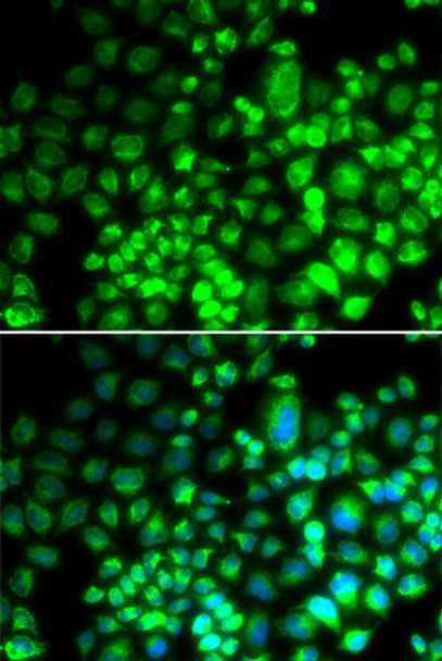 Anti-ST6GAL1 Antibody (CAB12504)