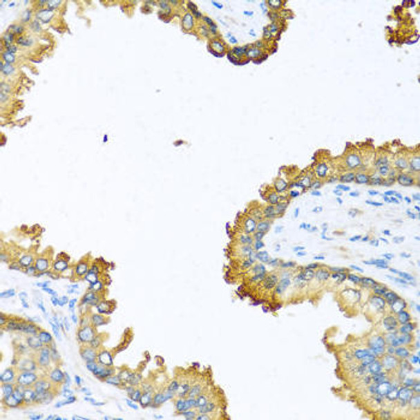 Anti-VEGFC Antibody (CAB12530)