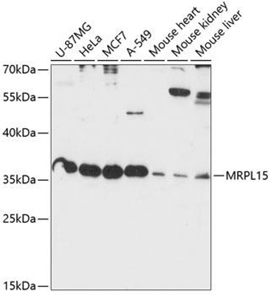 Anti-MRPL15 Antibody (CAB14400)