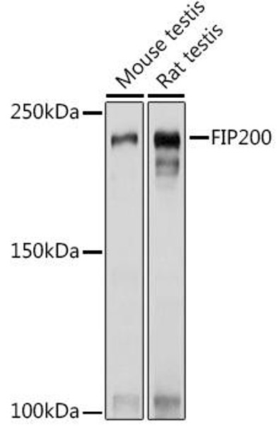 Anti-FIP200 Antibody (CAB14685)