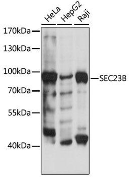 Anti-SEC23B Antibody (CAB15131)