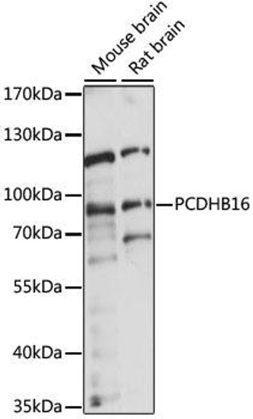 Anti-PCDHB16 Antibody (CAB15493)