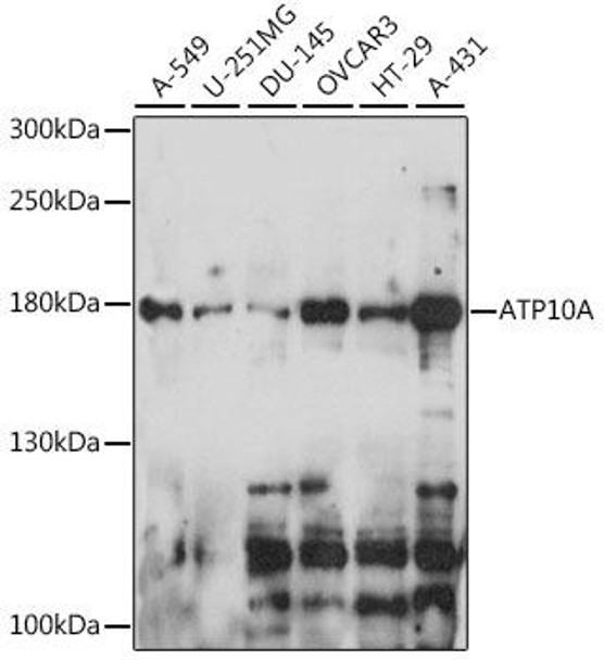 Anti-ATP10A Antibody (CAB15873)