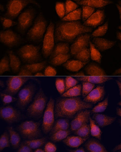 Anti-KIF13A Antibody (CAB15880)