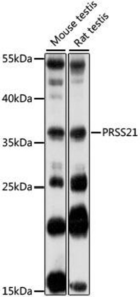 Anti-PRSS21 Antibody (CAB16100)