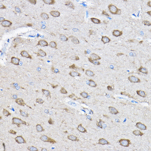 Anti-PTPN23 Antibody (CAB4595)