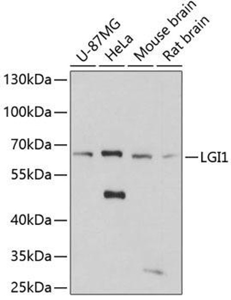 Anti-LGI1 Antibody (CAB5408)