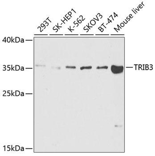 Anti-TRIB3 Antibody (CAB5424)