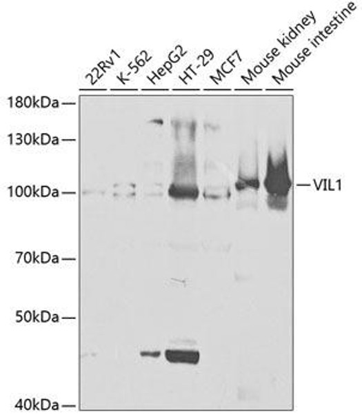 Anti-VIL-1 Antibody (CAB5494)