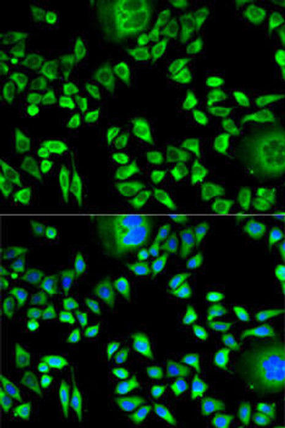 Anti-CSTA Antibody (CAB5686)