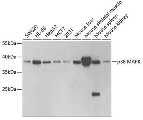 Anti-p38 MAPK Antibody (CAB0227)