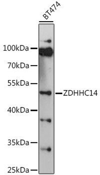 Anti-ZDHHC14 Antibody (CAB16644)