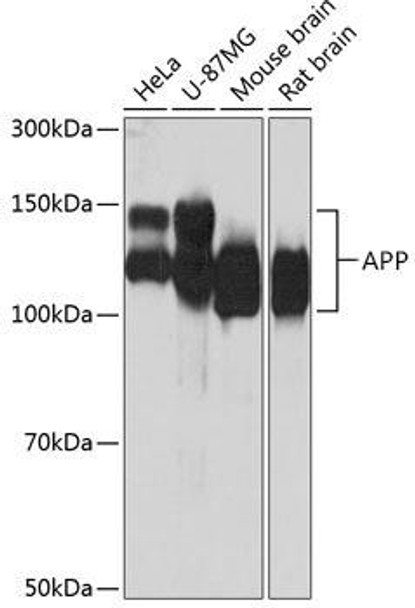 Anti-APP Antibody (CAB17911)[KO Validated]