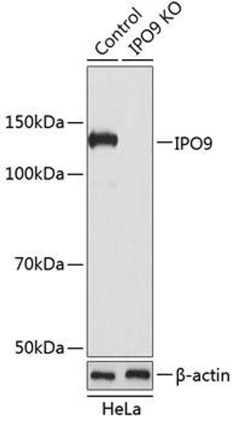 Anti-IPO9 Antibody (CAB19860)[KO Validated]