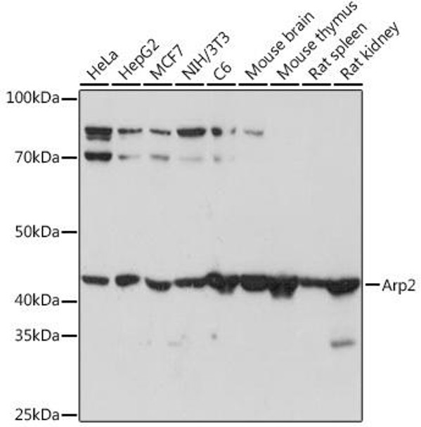 Anti-Arp2 Antibody (CAB8876)