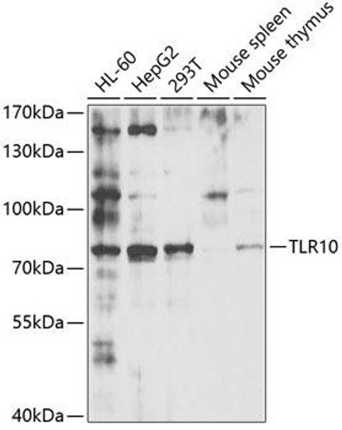 Anti-TLR10 Antibody (CAB5852)