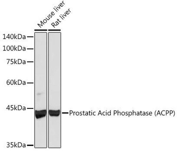 Anti-Prostatic Acid Phosphatase (ACPP) Antibody (CAB4138)