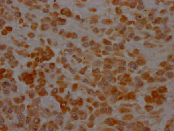 Anti-SERPINH1 Antibody (RACO0284)