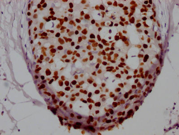 Anti-FOXA1 Antibody (RACO0308)