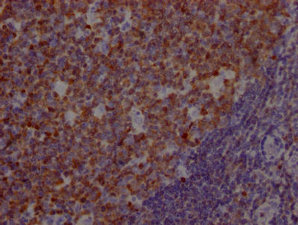 Anti-POU2AF1 Antibody (RACO0395)