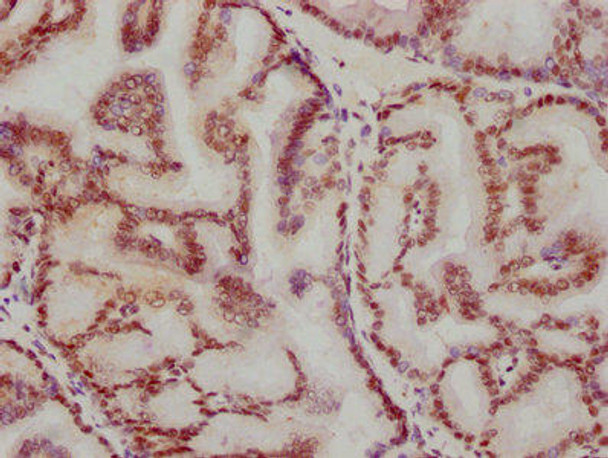 Anti-ATF2 Antibody (RACO0181)