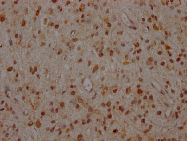 Anti-MAP2K1 Antibody (RACO0276)