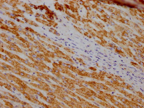 Anti-SOD2 Antibody (RACO0288)